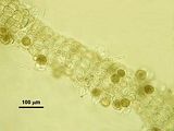 Dettaglio degli organi uniloculari